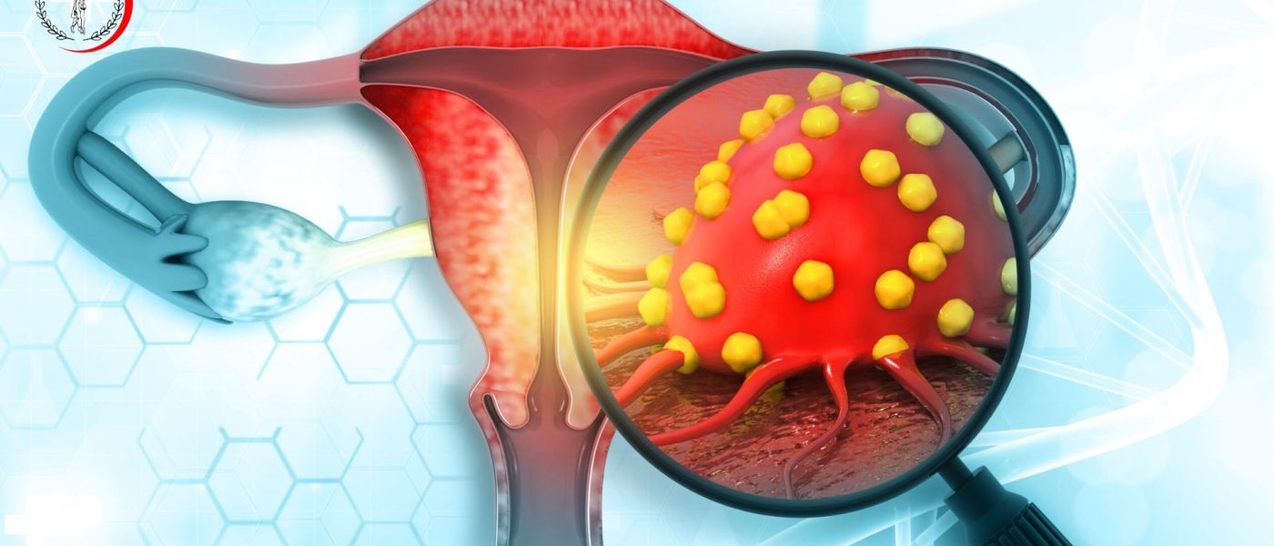 Common Gynecological Infections